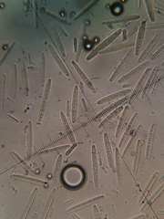 Tolypocladium longisegmentatum