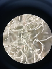 Usnea nidulans