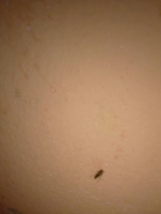 Isotomurus