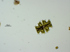 Micrasterias depauperata