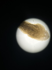 Platyhelminthes