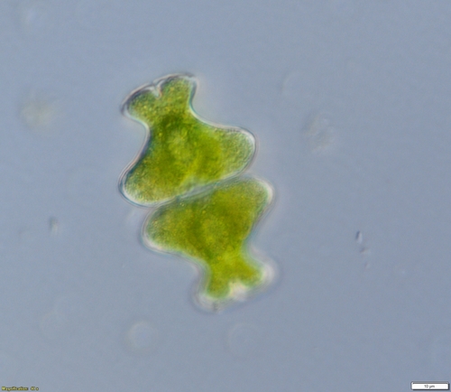 Euastrum intermedium