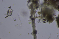 Pseudopediastrum boryanum