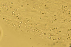 Fayodia bisphaerigera