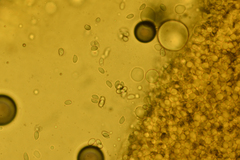 Pseudoomphalina intermedia