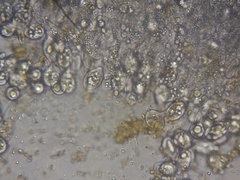 Entomophthorales