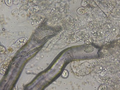 Entomophthorales