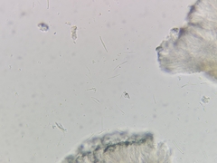 Bacidia circumspecta