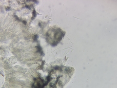 Bacidia circumspecta