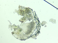 Bacidia circumspecta