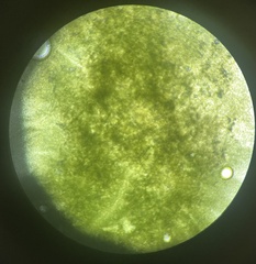 Aspergillus