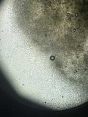 Aspergillus