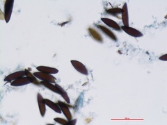 Kretzschmaria cetrarioides