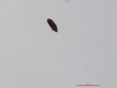 Kretzschmaria cetrarioides