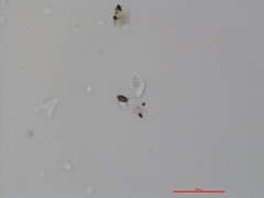 Xylaria bipindensis