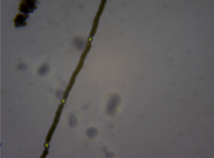 Dolichospermum