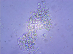 Microcystis