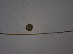 Dolichospermum