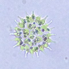 Pseudopediastrum boryanum