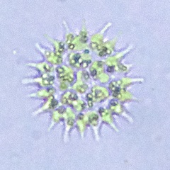 Pseudopediastrum boryanum