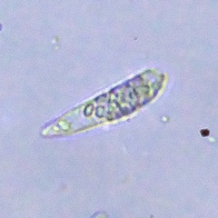 Euglenozoa
