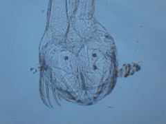 Chaetognatha