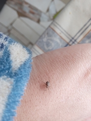 Steatoda grossa