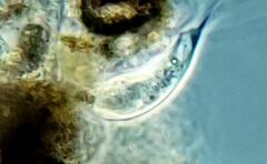 Tropidoatractus spinosus
