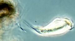 Tropidoatractus spinosus