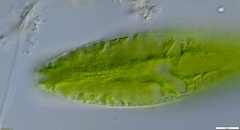 Netrium digitus