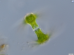 Staurastrum ankyroides