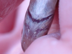 Catostomus catostomus