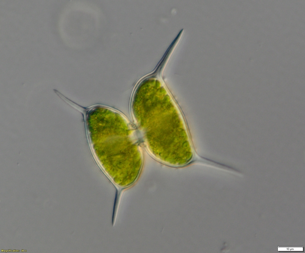Staurodesmus validus