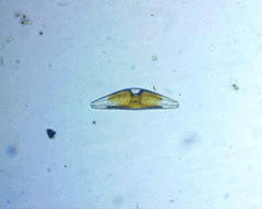 Cymbella