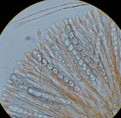 Scutellinia
