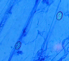 Scutellinia