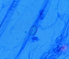 Scutellinia