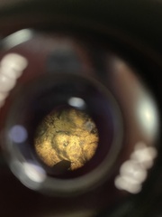 Lobarina scrobiculata