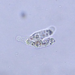 Amoebidae