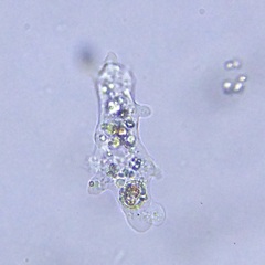 Amoebidae