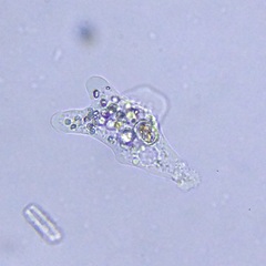 Amoebidae