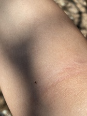 Amblyomma americanum