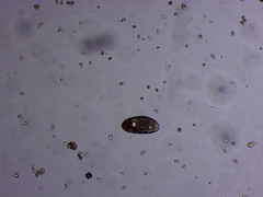 Paramecium
