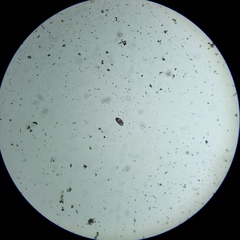 Paramecium