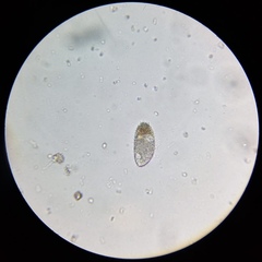 Paramecium