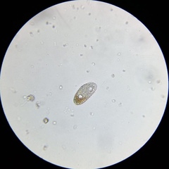 Paramecium