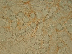 Pulvinula convexella