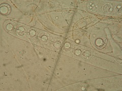 Pulvinula convexella
