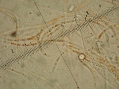 Pulvinula convexella