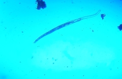 Spirostomum